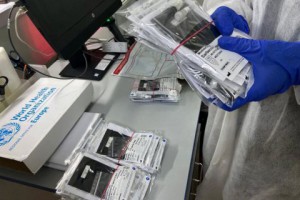 Украина закупила 15 тысяч тестов на коронавирус через систему «Prozorro»