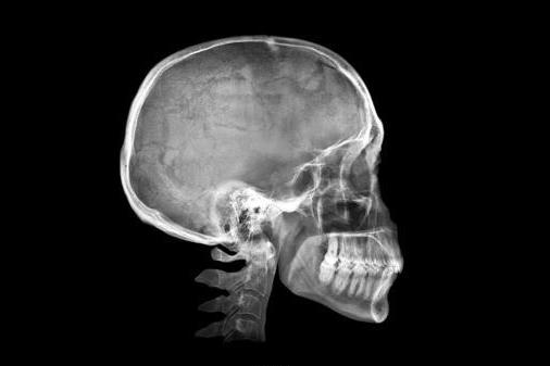 Из-за смартфонов у человека начали расти шипы на черепе