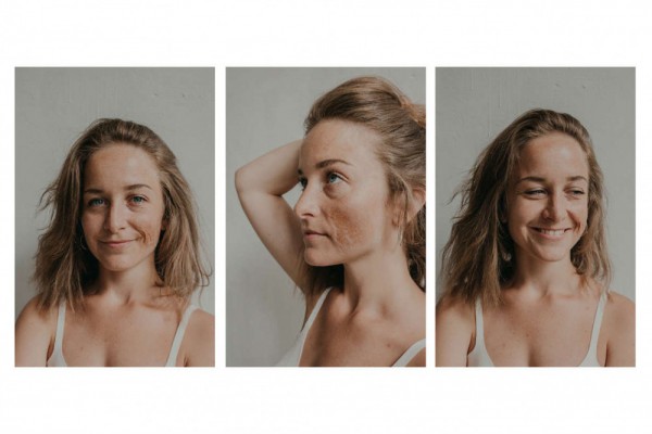 В Киеве открылась необычная фотовыставка шрамов. Фото