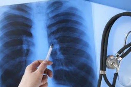 Где киевляне могут бесплатно сделать «флюшку» в феврале