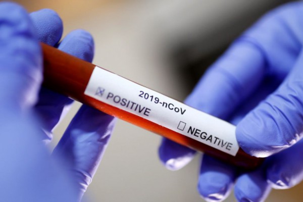 Коронавирус в Украине: статистика распространения на сегодня