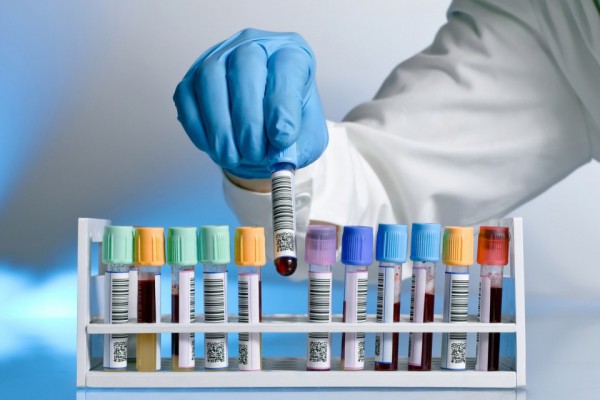 Коронавирус в Украине: статистика распространения на сегодня