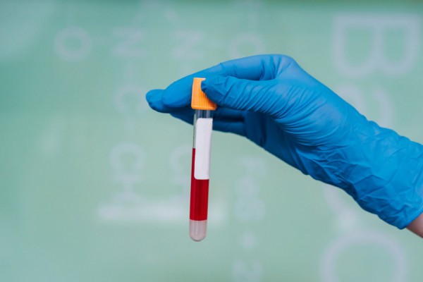 Коронавирус в Украине: статистика распространения на сегодня