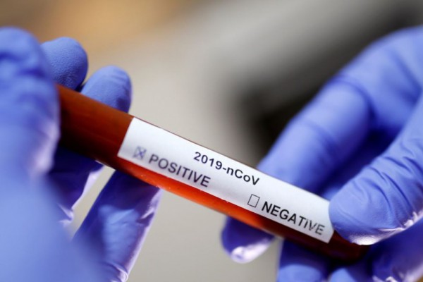 Коронавирус в Украине: статистика распространения на сегодня