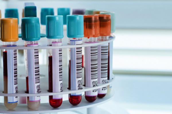 Коронавирус в Украине: статистика распространения на сегодня