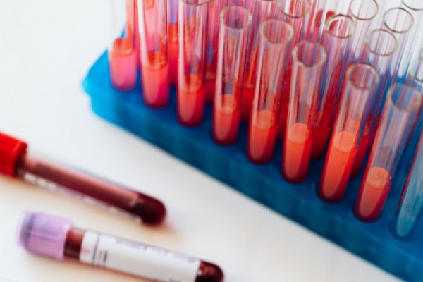 Коронавирус в Украине: статистика распространения на сегодня