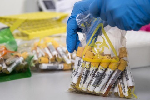 Коронавирус в Украине: статистика распространения на сегодня