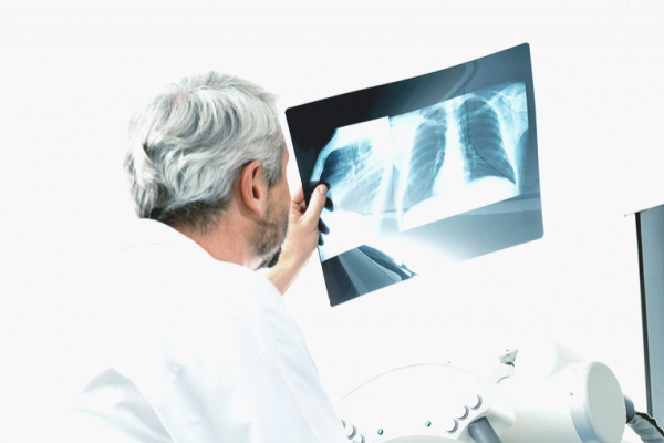 Теперь украинцы смогут бесплатно пройти томографию и рентген в рамках «ковидного» пакета