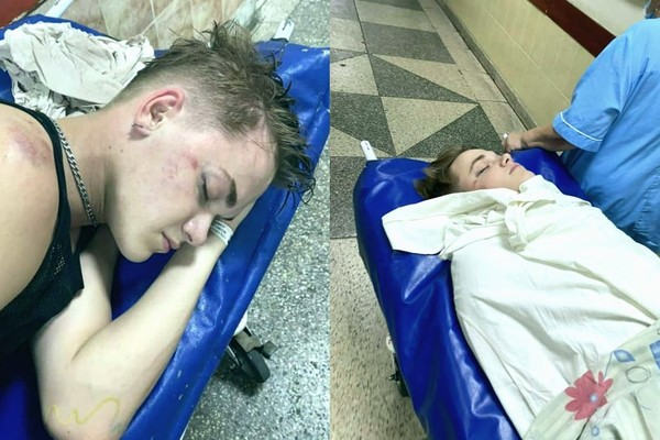 В Киеве у клуба до комы избили танцора певицы Нади Дорофеевой