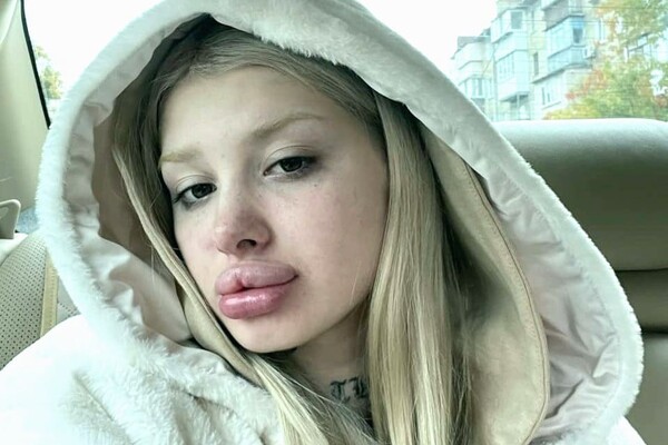 Скандальная украинская блогерша ttiisshhiinnaa 