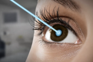 Лазерная коррекция как самый эффективный метод восстановления зрения