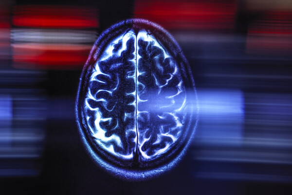 Нейробиологи нашли 